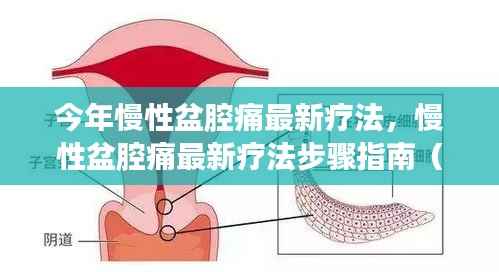 今年慢性盆腔痛最新疗法详解,步骤指南与初学者进阶教程