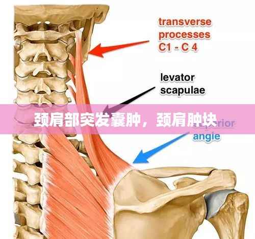 颈肩部突发囊肿,颈肩肿块