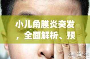 小儿角膜炎突发,全面解析、预防与治疗策略